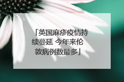 英国麻疹疫情持续蔓延 今年来伦敦病例数最多